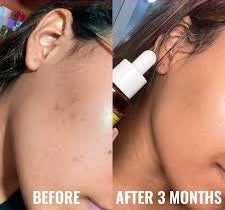 Discoloration correcting serum 30ml