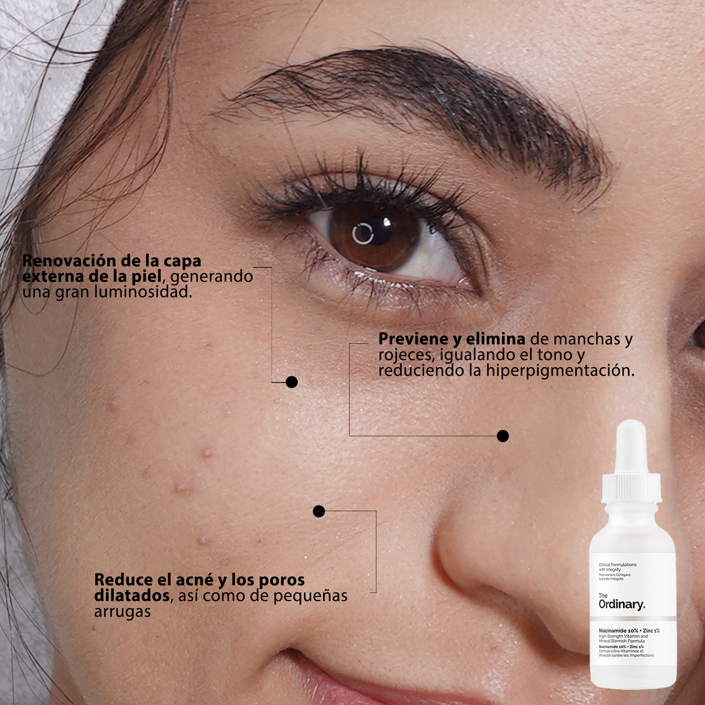 Niacinamida 10% + zinc - The Ordinary