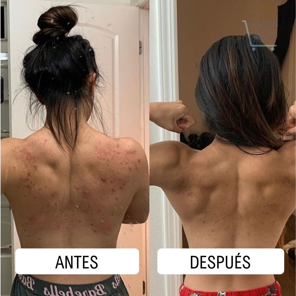 PanOxyl peroxido de benzoilo 10% Limpiador para piel con ACNE